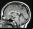 Cómo se comporta el cerebro ante los estímulos violentos Cómo se comporta el cerebro ante los estímulos violentos